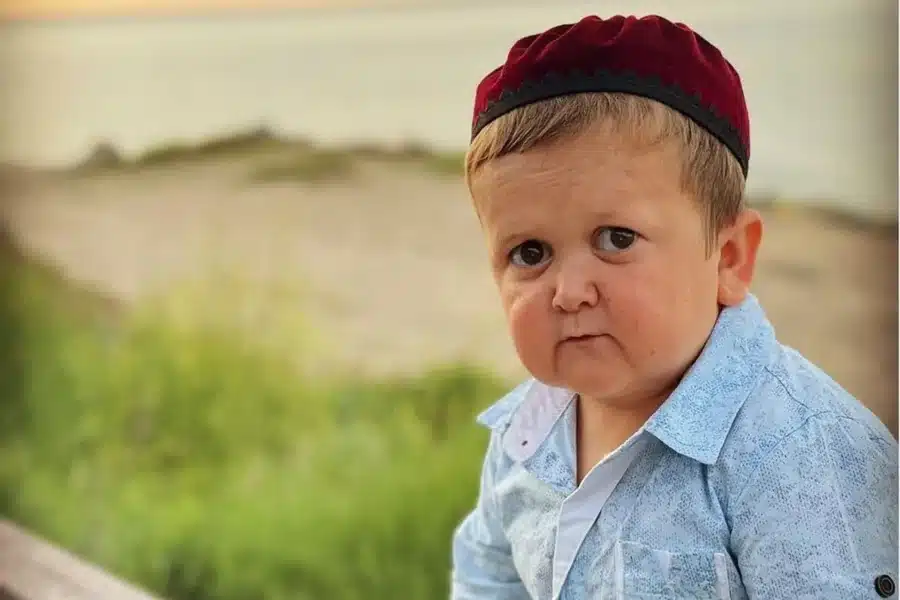 Hasbulla Age